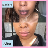 Pink Lips Cream (Improved Stronger formula) - Vol 2
