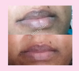 Pink Lips Cream (Improved Stronger formula) - Vol 2