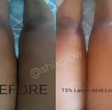 15% Shixglow Lactic Lotion - 300g