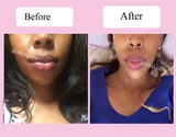 Pink Lips Cream (Improved Stronger formula) - Vol 2