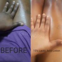 15% Shixglow Lactic Lotion - 300g