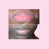 Pink Lips Cream (Improved Stronger formula) - Vol 2