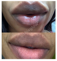 Pink Lips Cream (Improved Stronger formula) - Vol 2